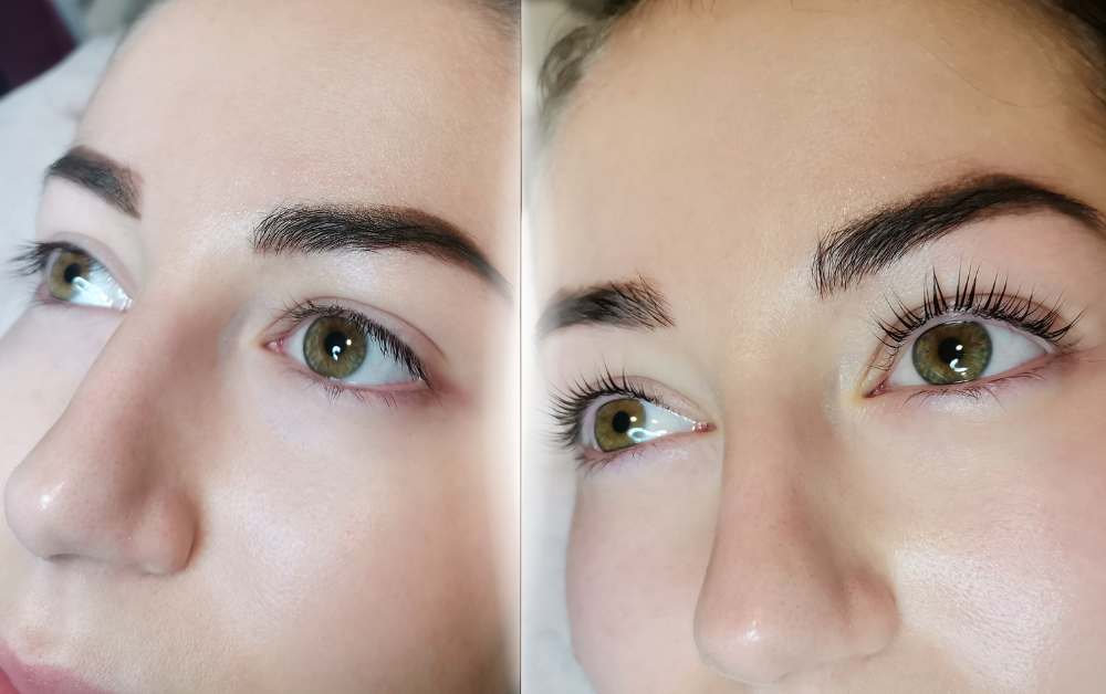Wings Beauty Szalon - Hajgyógyászat, szakszerű segítség hajhullás ellen